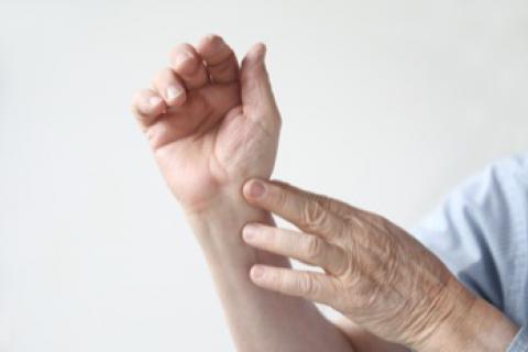 Hábitos que empeoran los síntomas de la artritis