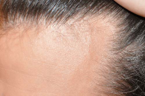 Aceites naturales para estimular el crecimiento del pelo